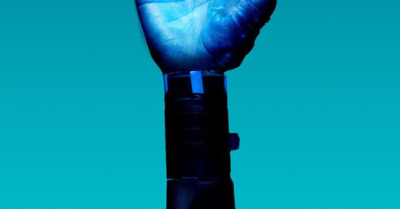 AI Innovation - Prosthetic Arm on Blue Background